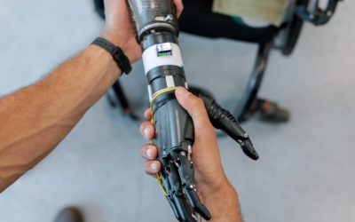 Kan ik aan sport doen met mijn prothese?